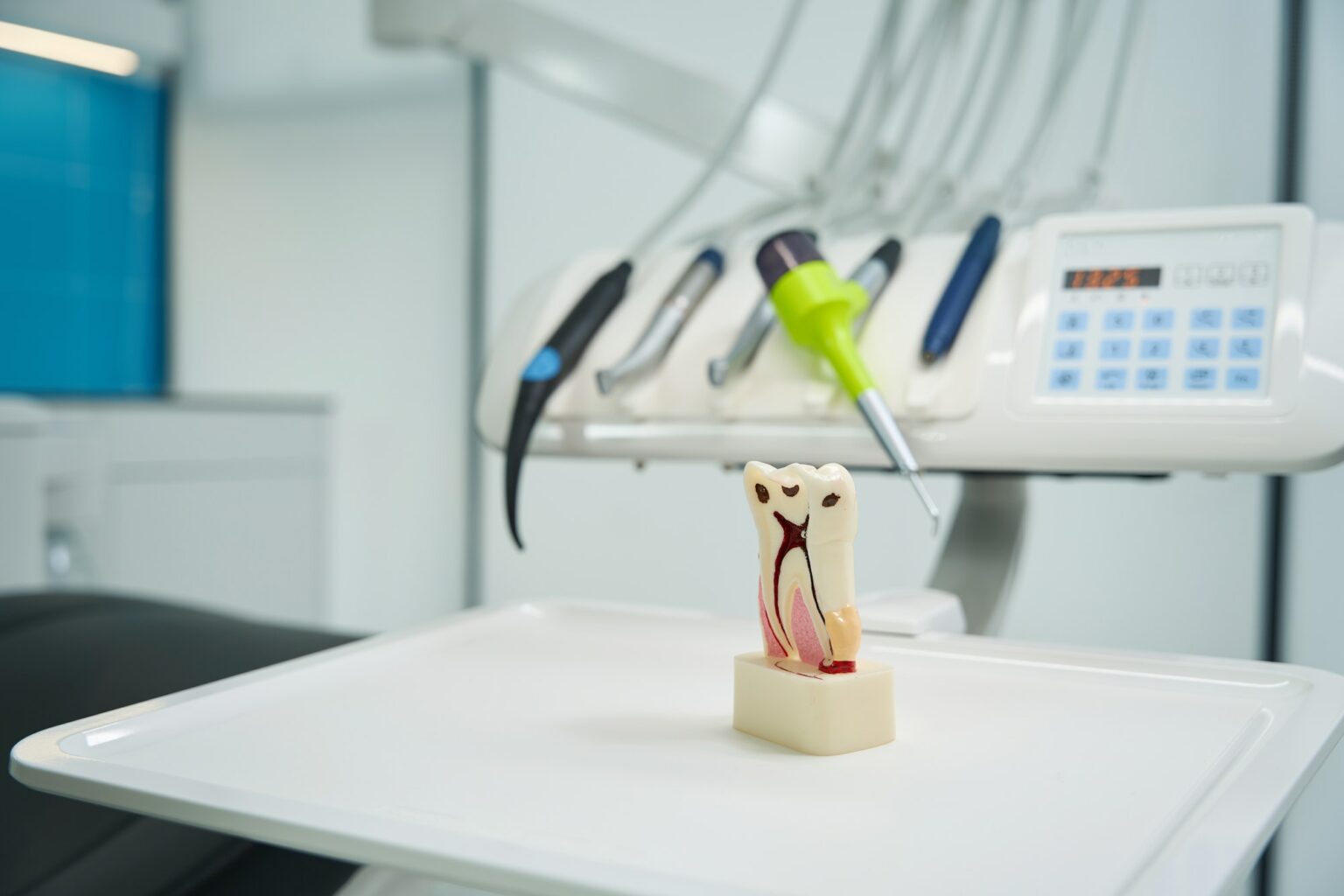 Close-up of tooth model with root canals and caries